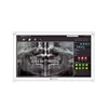 Kép 2/4 - AG Neovo DR-2202 Dental monitor,21.5" LED IPS fehér, NeoV, Sterilizálható,FHD